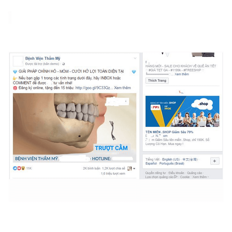 Quảng cáo bài viết Quảng cáo bài viết